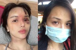 Trước siêu mẫu Khả Trang, nhiều sao nữ cũng từng bị bạo hành đến 'thân tàn ma dại'