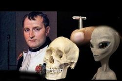 Nóng: Người ngoài hành tinh 'cả gan' cấy vi mạch vào hộp sọ Napoleon?
