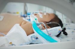 Bé gái nguy kịch vì hội chứng 'công chúa tóc mây'
