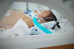 Bé gái 4 tuổi cấp cứu vì hội chứng 'cô bé tóc mây' hiếm gặp