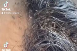 Tới salon với mái tóc lúc nhúc hàng triệu con chấy 'siêu to' bò xuống cả trán, cô bé khiến chuyên gia khóc thét và cái kết ngỡ ngàng ở cuối