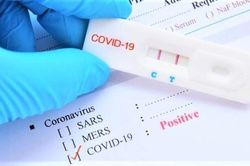 TP HCM yêu cầu rà soát việc nhập khẩu, mua sắm các loại kit test xét nghiệm