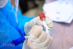 Sở Y tế thông tin về việc mua test xét nghiệm của Công ty Việt Á