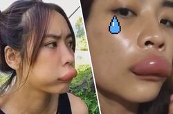 Clip: Tai nạn dở khóc dở cười khi ăn mật ong rừng nguyên chất