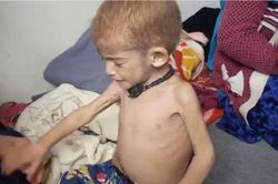 Nạn đói đang hoành hành ở Afghanistan