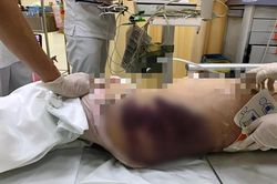 Tạm giữ người phụ nữ nghi bạo hành khiến bé 8 tuổi tử vong