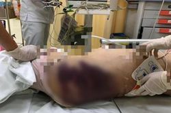 Bắt 'dì ghẻ' bạo hành khiến bé gái 8 tuổi tử vong