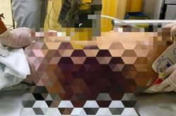 UBND TPHCM chỉ đạo khẩn vụ 'dì ghẻ' bạo hành bé gái 8 tuổi đến chết
