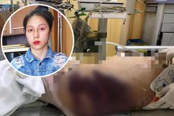 Vụ bé gái 8 tuổi tử vong nghi bị bạo hành: Dì ghẻ đối diện tội danh nào?