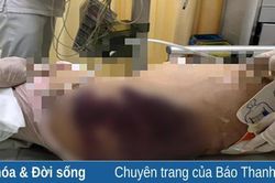 Ngẫm về câu ca: 'Mấy đời bánh đúc có xương'…