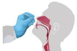 CDC Hà Nội hướng dẫn người dân dùng test nhanh vi rút SARS-CoV-2 tại nhà