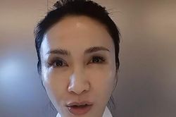 'Đệ nhất mỹ nhân TVB' Lê Tư gây sốc với khuôn mặt đơ cứng