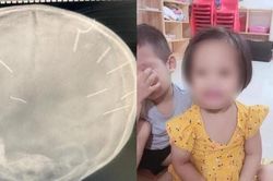 Toàn cảnh vụ bé gái 3 tuổi bị đinh găm vào đầu: Xác định nghi phạm là người tình của mẹ