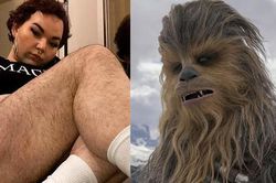 Cô gái mọc lông khắp cơ thể bị trêu chọc là Chewbacca trong phim 'Star Wars'