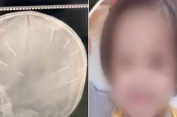 Diễn biến mới nhất vụ bé gái 3 tuổi có 9 vật thể giống đinh găm vào hộp sọ, nghi bạo hành gây chấn động