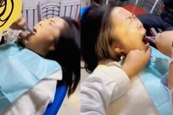 Nhổ răng khôn, bác sĩ khiến ai cũng hết hồn vì hành động này