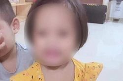 Thực hư thông tin bé 3 tuổi bị đóng đinh vào đầu được phẫu thuật thành công
