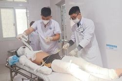 Nam sinh bị bỏng nặng khi đốt pháo hoa lúc cận Tết