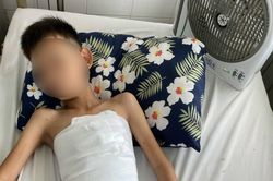 Khánh Hòa: Cấp cứu, điều trị cho bệnh nhi bị đa chấn thương do pháo nổ