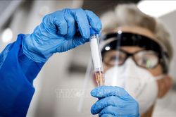 Nga phát triển công nghệ phát hiện virus SARS-CoV-2 ở giai đoạn sớm