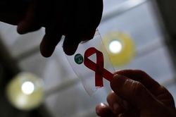 Người phụ nữ đầu tiên trên thế giới được chữa khỏi HIV nhờ cấy ghép tế bào
