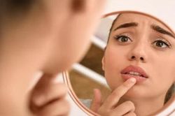 COVID-19 có thể làm phát sinh các biến chứng về da?