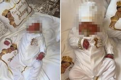 'Dát' vàng khắp người bé trai sơ sinh, bà mẹ gây phẫn nộ