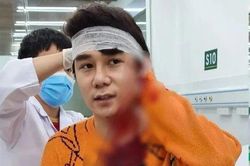 Diễn viên Ngô Sỹ Lâm trình báo bị chém sau va chạm giao thông