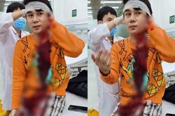 Bắt nghi phạm chém trọng thương nam diễn viên phim 'Thương ngày nắng về'