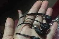 Trẻ 9 ngày tuổi ngừng thở, ngừng tim do uống mật khỉ