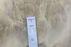 Có hiện tượng đầu cơ, tăng giá bộ sinh phẩm xét nghiệm SARS-CoV-2