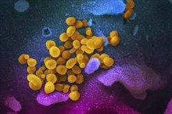Xét nghiệm nhanh virus SARS-CoV-2 với công nghệ không xâm lấn, chi phí thấp