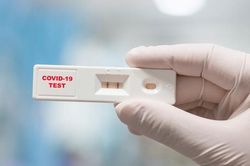 Khan hiếm, loạn giá kit – test xét nghiệm Covid-19: Bộ Y tế nói gì?