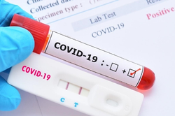 Xét nghiệm PCR COVID-19: Chỉ số Ct càng cao càng khó lây nhiễm