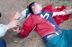 Kinh hoàng người đàn ông bị chiếc xà beng đâm xuyên qua người