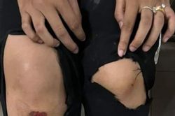 Hai nữ học sinh lớp 11 đạp ngã đối tượng giật điện thoại