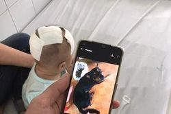 Cứu chữa kịp thời bé gái bị thú cưng cắn xuyên sọ