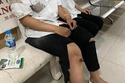 Hai nữ sinh lớp 11 truy đuổi, đạp ngã xe bọn cướp lấy lại ĐTDĐ bị giật