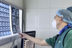 Mắc COVID-19, nam thanh niên ho ra máu ồ ạt