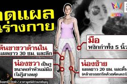 Công bố toàn bộ vết thương trên người diễn viên Chiếc Lá Cuốn Bay, hé lộ một người có khả năng bị khởi tố