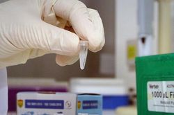 Bộ Y tế triển khai nhiều giải pháp ngăn 'loạn' giá kit-test xét nghiệm