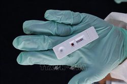 Trung Quốc cho phép bán đại trà kit test nhanh COVID-19