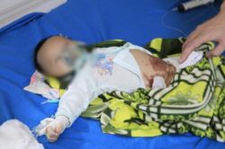 Đắp tỏi điều trị COVID-19, bé sơ sinh 2 tháng nhập viện nguy kịch