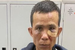 Kẻ có 6 tiền án lại 'ngựa quen đường cũ' đi trộm cắp tài sản
