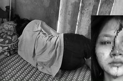 Nữ sinh Huế bị bạn học cùng trường đánh chấn động não