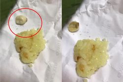 Đang ăn xôi bất ngờ nhai trúng vật lạ 'ghê rợn', cô gái băn khoăn có nên ăn tiếp