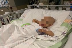 Điều trị thành công bệnh nhi bị u nguyên bào thận 2 bên
