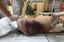 Bé gái 7 tuổi ở TP.HCM nghi bị bạo hành tử vong