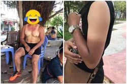 Những 'thảm cảnh' cháy nắng mùa hè không biết nên khóc hay nên cười