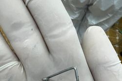 Kinh hãi chuyện bé trai 9 tuổi tự nhét lò xo vào cổ họng